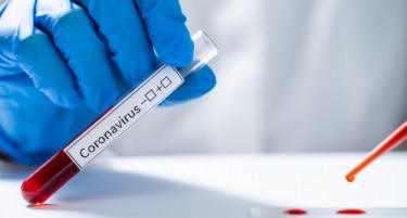 Нови 929 заразени и 28 починати од коронавирусот
