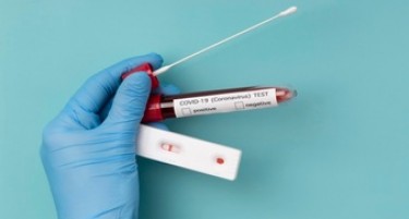 Регистрирани се 377 нови случаи на КОВИД-19 и 12 починати за едно деноноќие